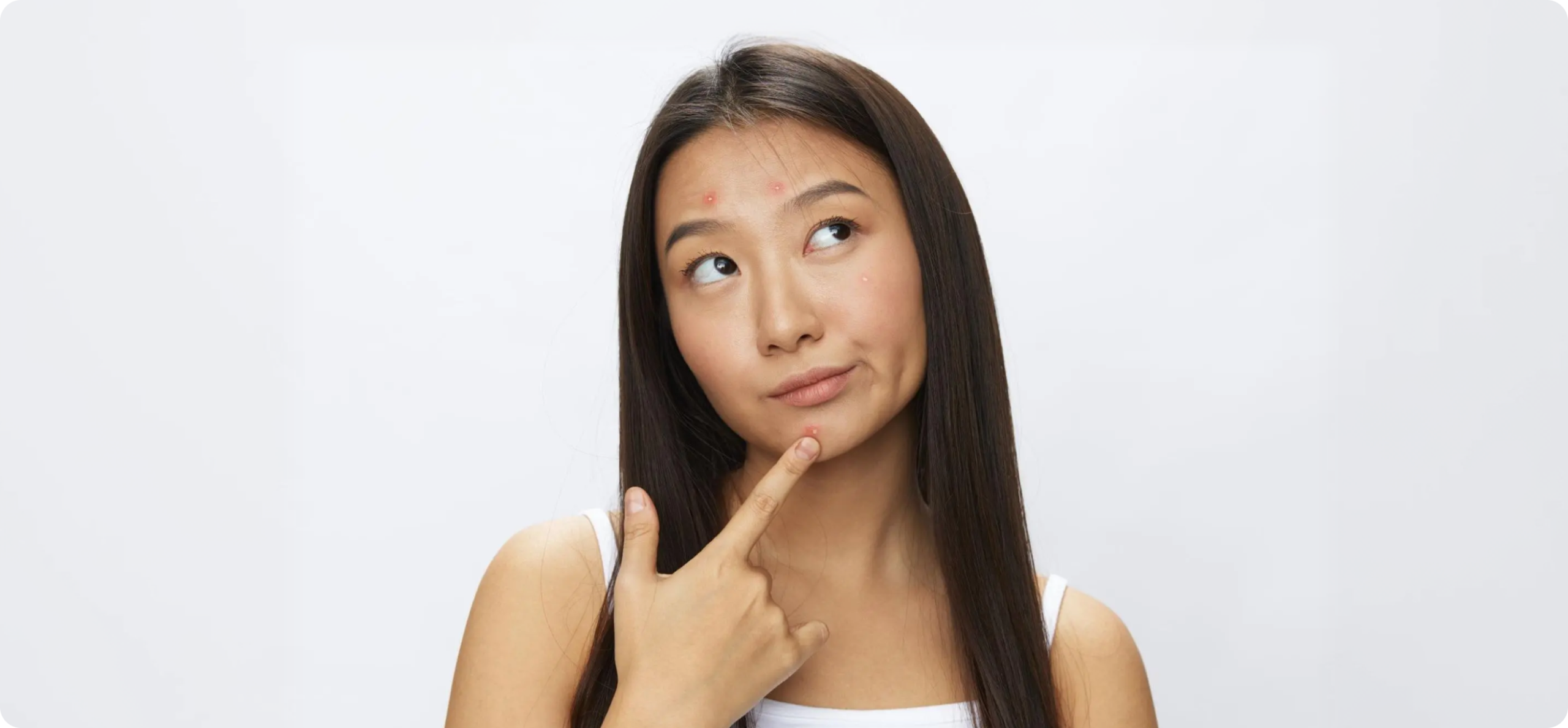 Vitamins Reduce Acnes Articles Featured Image